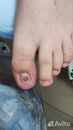 Услуги подолога