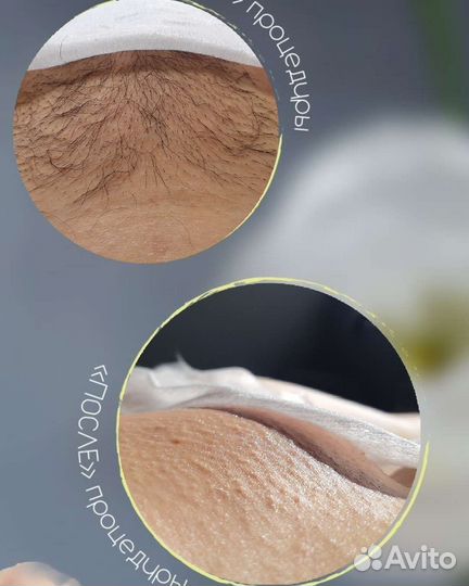 Шугаринг/ваксинг