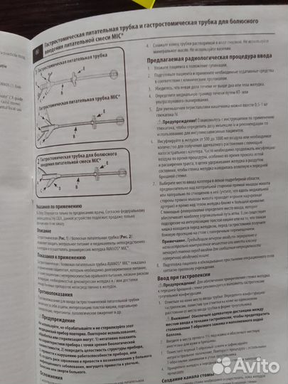 Гастростомическая питательная трубка