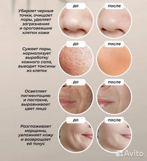 Ультразвуковая чистка лица