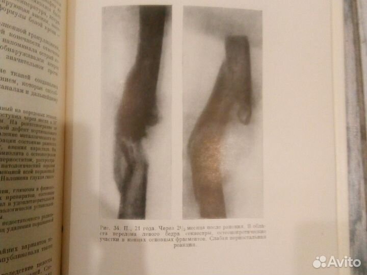 Опыт советской медицины в ВОВ 41 45г