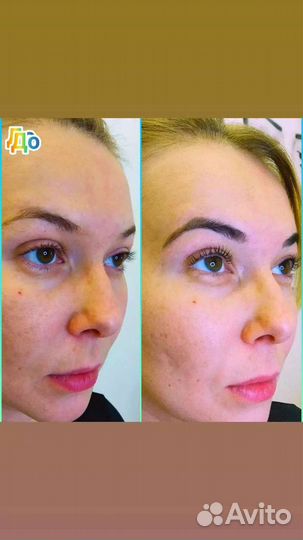 Ламинирование ресниц и бровей