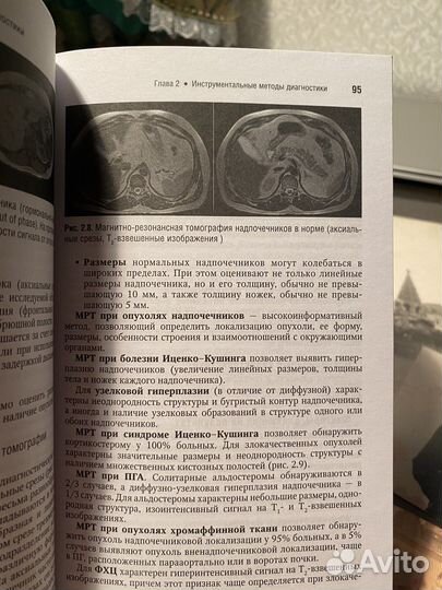 Книга эндокринология