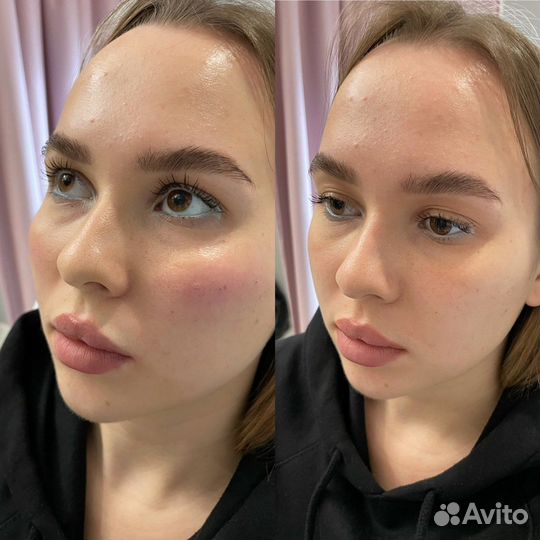 Обучение косметологии с нуля