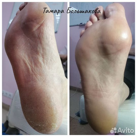 Маникюр и педикюр