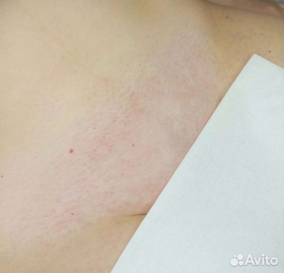 Мастер по шугарингу