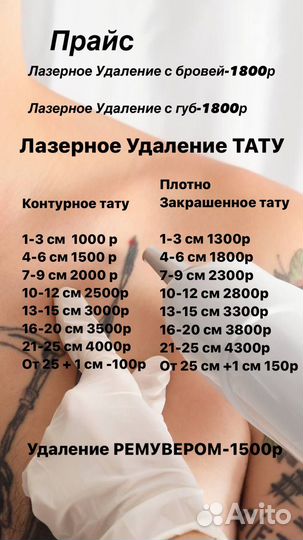 Удаление тату и татуажа Зеленые Горки