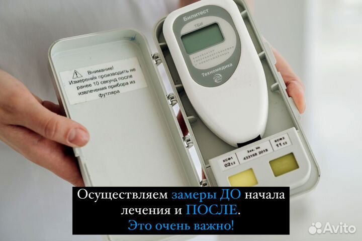 Лампа от желтушки. Лечение желтухи и билитест