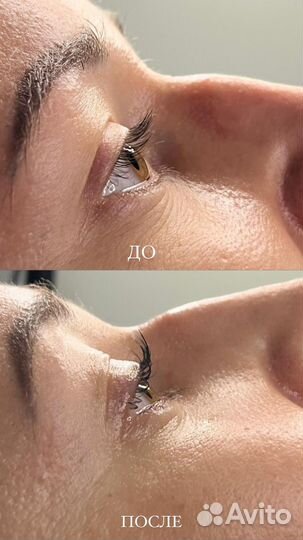 Ламинирование ресниц