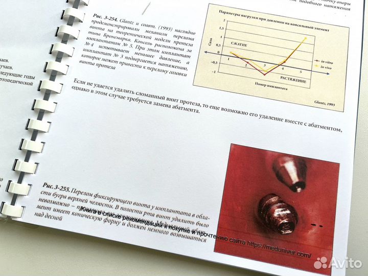 Устранение осложнений имплантологического лечения