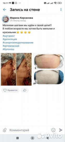 Шугаринг. Сахарное моделирование лица и тела