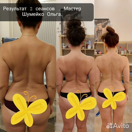 Массаж. Фитобочка кедровая