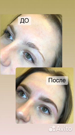 Бровист Кимры