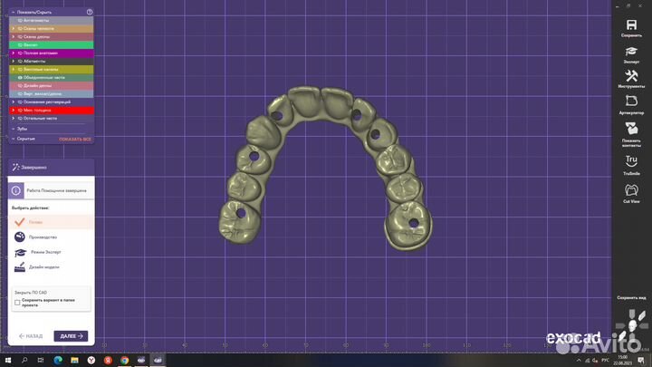 Циркониевая коронка - 3600ед