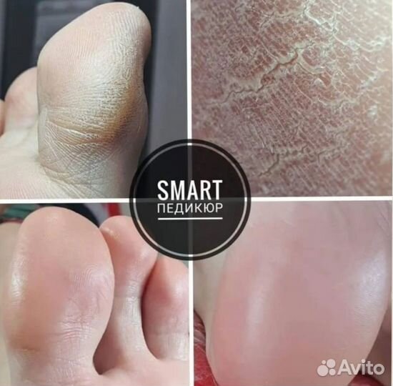 Педикюр SMART