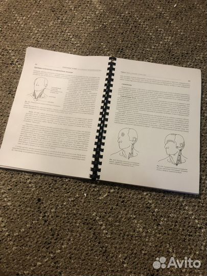 Книга триггереые точки