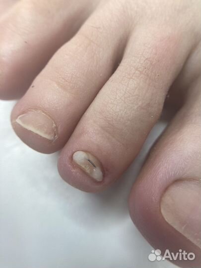 Модель на титановую нить (педикюр)