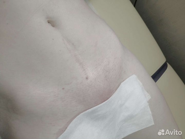 Восковая депиляция