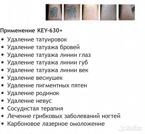 Неодимовый лазер KEY -630 +