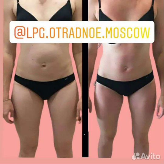 LPG, Слимсфера