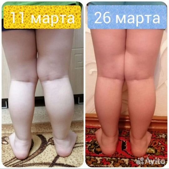 Детский массаж, логопедический массаж