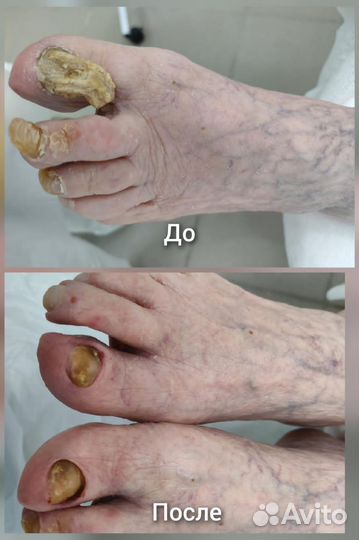 Подолог, услуги подолога