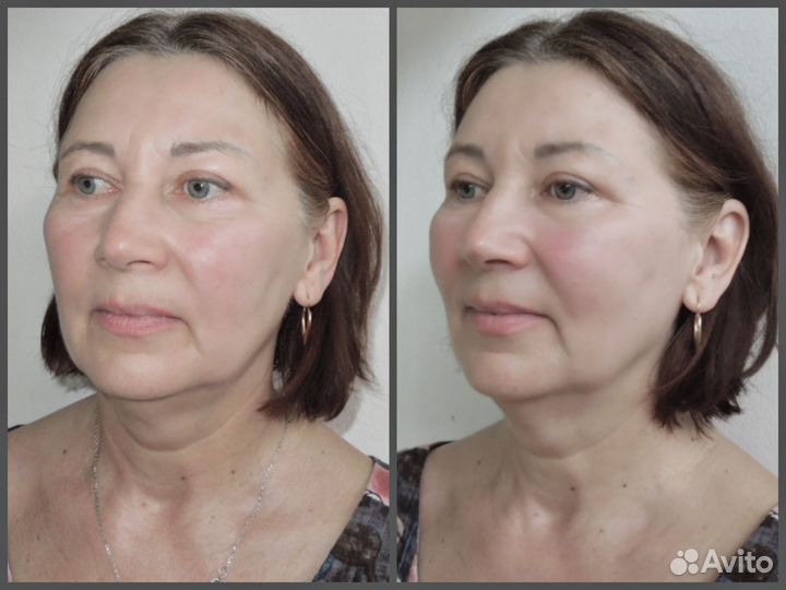 Услуги косметолога