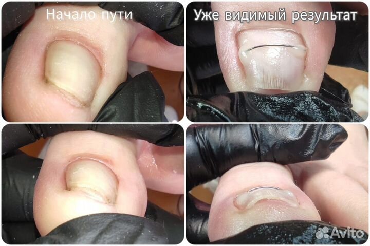 Педикюр, подолог (проблема стопы и ногтей)
