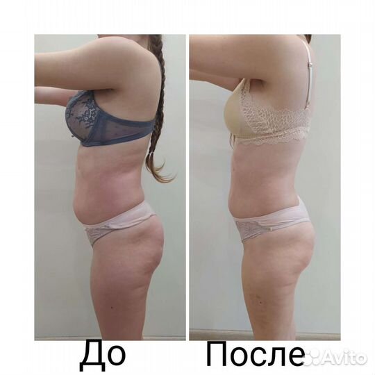 Массаж тело лицо, классика,коррекция фигуры,релакс