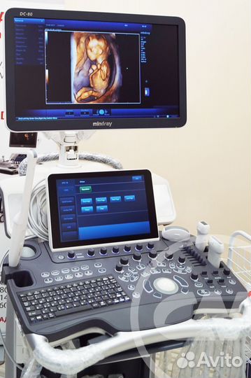 Узи аппарат Mindray DC-80 X-Insight (гинекология)