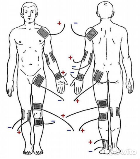 Аппарат физиотерапии