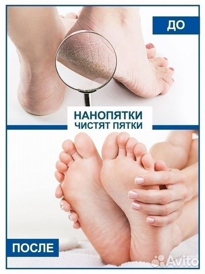 Нанопятки