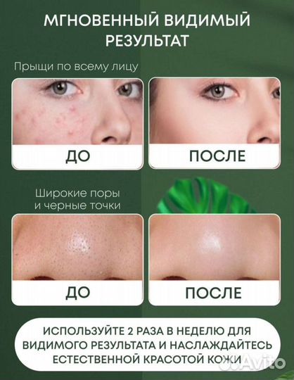 Вакуумный очиститель пор