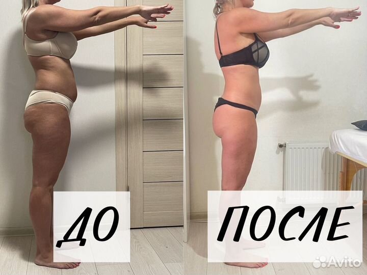 Аппаратный массаж. Антицеллюлитный массаж. Массаж