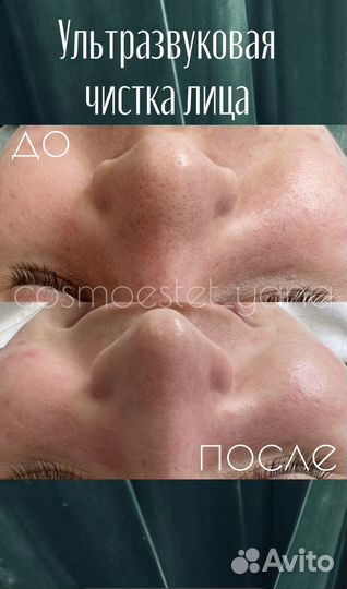 Косметолог Псков