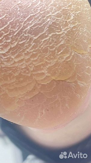 Маникюр/педикюр на дому