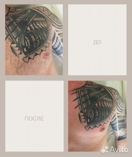 Шугаринг Мужской-женский сахарная депиляция