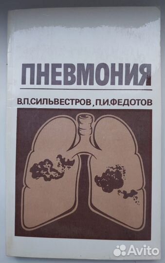 Книга для терапевта 1987г. Пневмония./Сильвестров