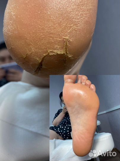 Маникюр гель лак Smart педикюр Химки