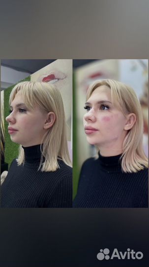 Требуются модели на нити. Косметолог