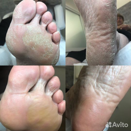 Подолог Балашиха