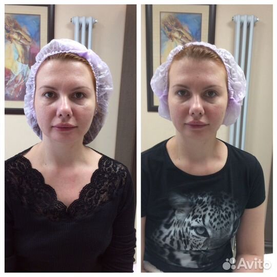 Скульптурный массаж лица