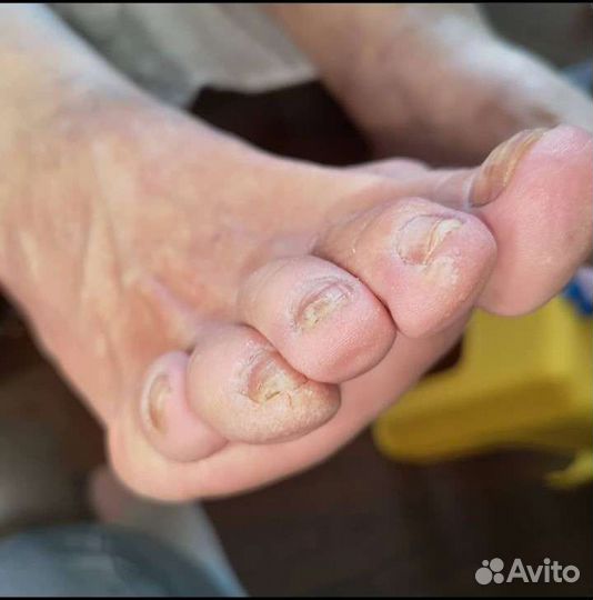 Педикюр с выездом на дом