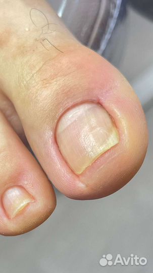 Маникюр/педикюр на дому