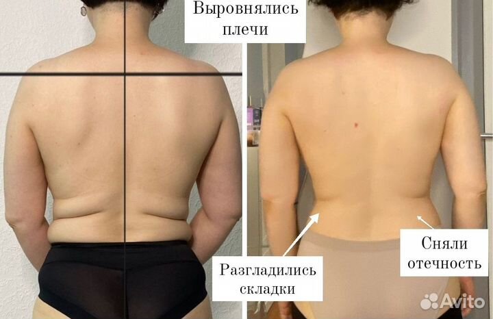 Омолаживающий коррекционный массаж лица и тела