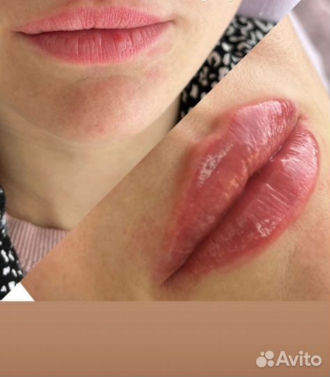 Услуги косметолога