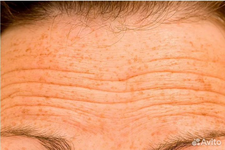 Массаж лица