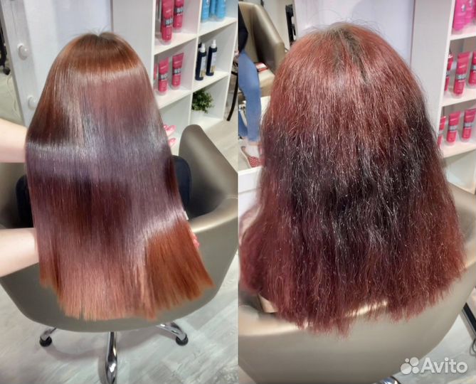 Ботокс, Биксипластия, Кератин