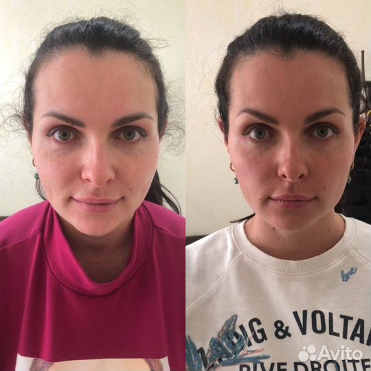 Скульптурный массаж лица