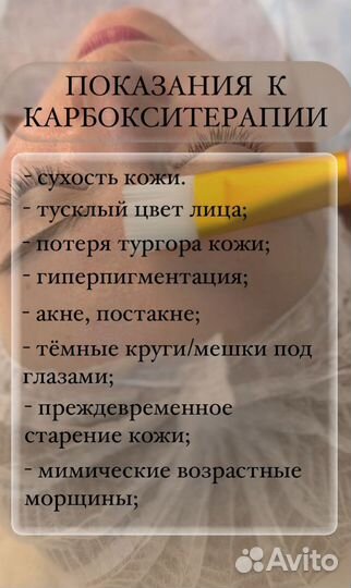 Карбокситерапия неинвазивная